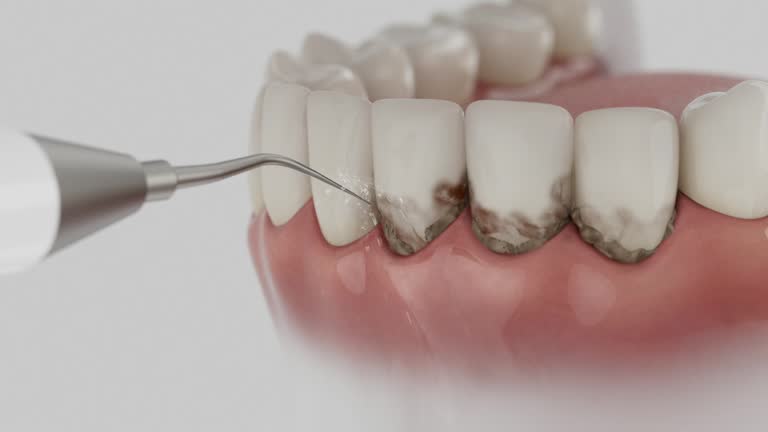 Reliable Emergency Dentist contractor in Polson, MT by Smile Center Dentistry